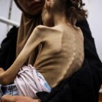 Gazze’de 9 yaşındaki Meryem, 25 kilodan 10 kiloya düştü